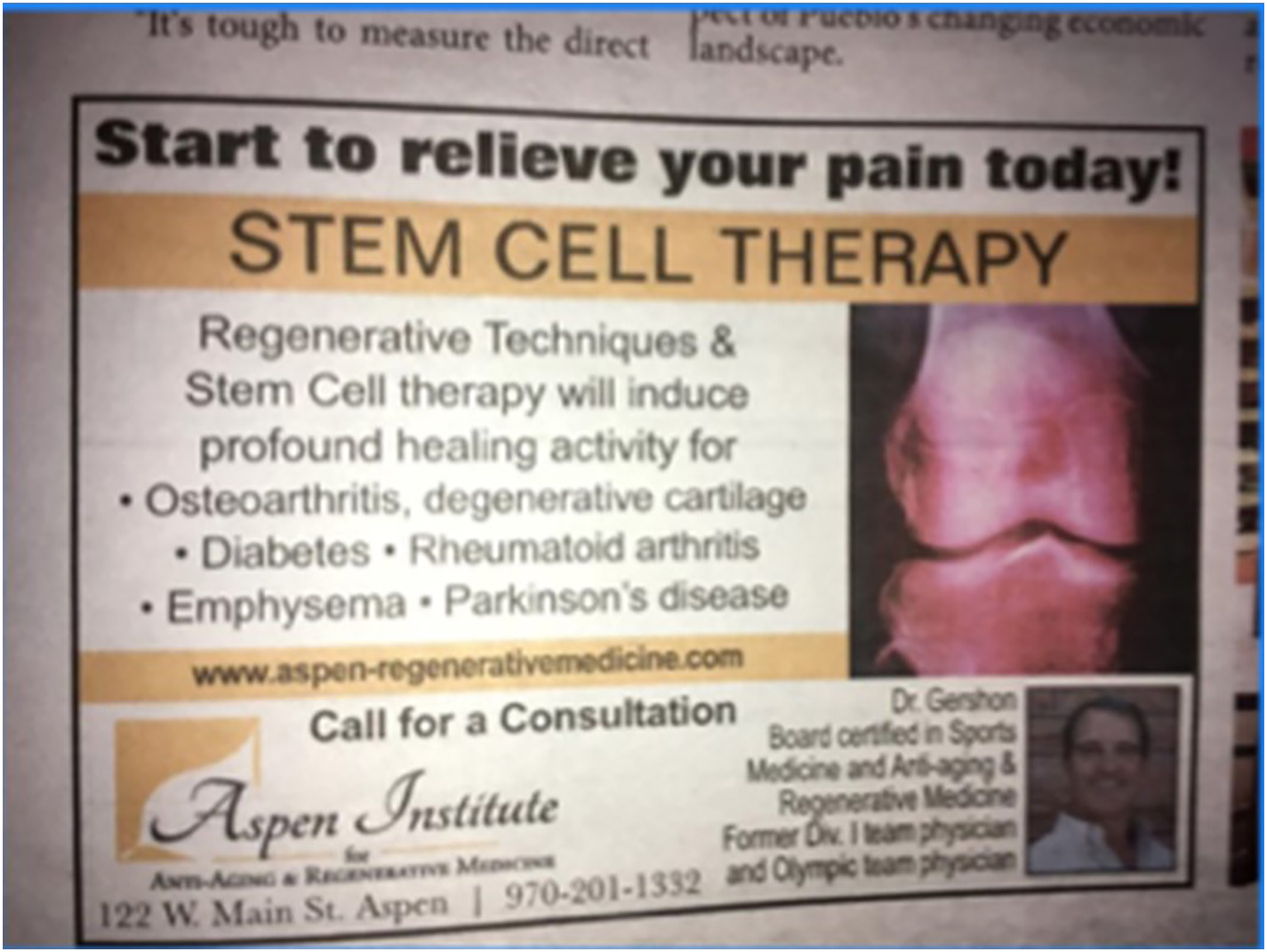 間充質干細胞治療1型糖尿病臨床應用案例