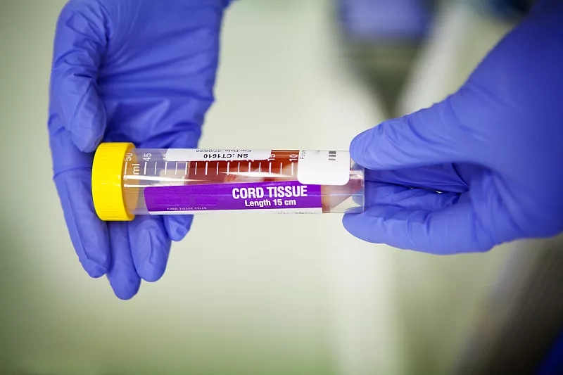 間充質(zhì)干細胞的優(yōu)點有哪些? 間充質(zhì)干細胞的優(yōu)點有哪些?