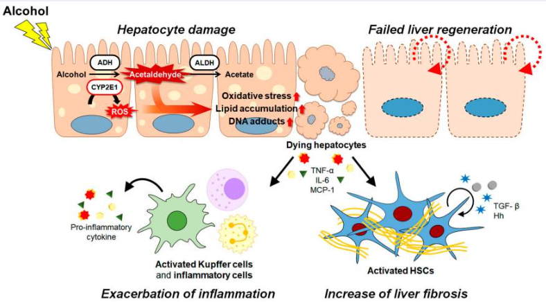 酒精及其代謝物通過各種途徑和/或機制共同促進ALD的發病機制。（如圖1）