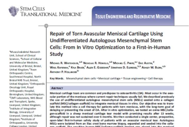 間充質(zhì)干細(xì)胞能夠幫助修復(fù)受損的半月板組織，不用手術(shù)切除受傷部位也能讓膝關(guān)節(jié)功能恢復(fù)正常。