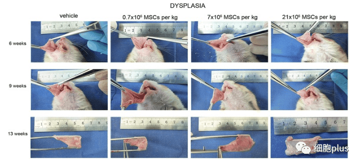 在腫瘤增生期，全身注射同種異體間充質(zhì)干細胞不會加速癌前病變的進展。