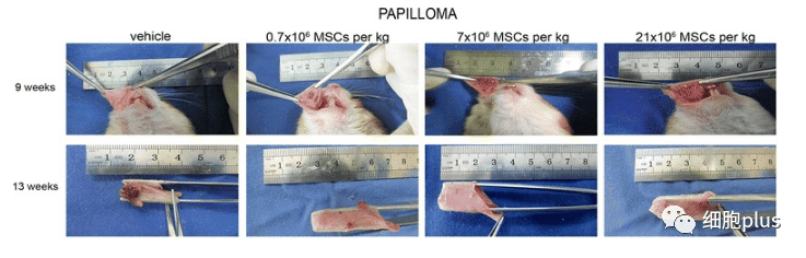 在非典型增生期，全身注射同種異體間充質(zhì)干細胞不會加速癌前病變的進展。