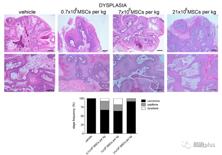 在增生期，全身注射同種異體間充質(zhì)干細胞不會增加腫瘤的惡性程度。