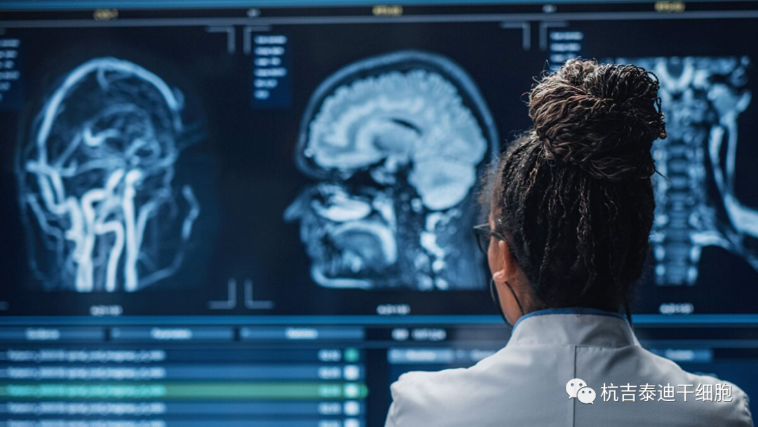 干細胞治療神經退行性疾病臨床試驗研究進展