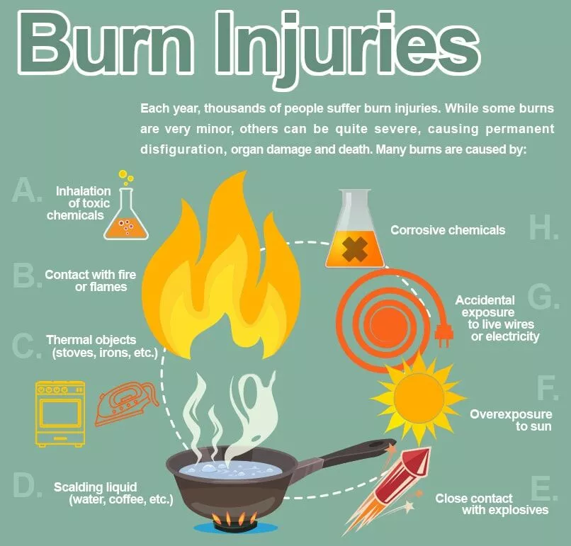 燒傷原因 燒傷原因