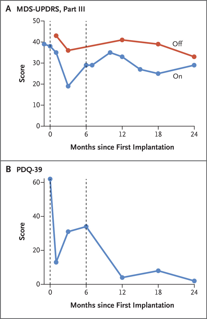 圖3.帕金森病相關運動能力和生活質量的橫向臨床評估。