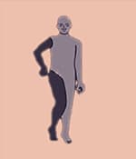 這種類型的腦癱表現(xiàn)為四肢僵硬。 這種類型的腦癱表現(xiàn)為四肢僵硬。