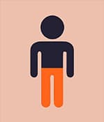 雙側(cè)腦癱,影響雙腿或雙臂。 雙側(cè)腦癱,影響雙腿或雙臂。