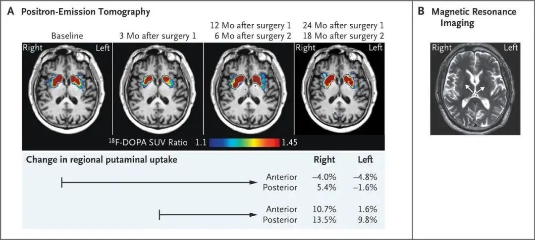 -?斷層掃描圖像?- -?斷層掃描圖像?-