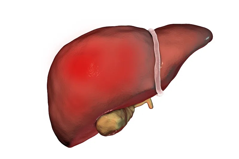 什么是丁型肝炎？