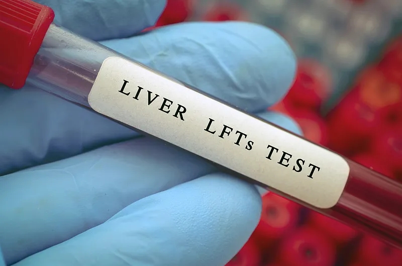 診斷酒精相關的肝病