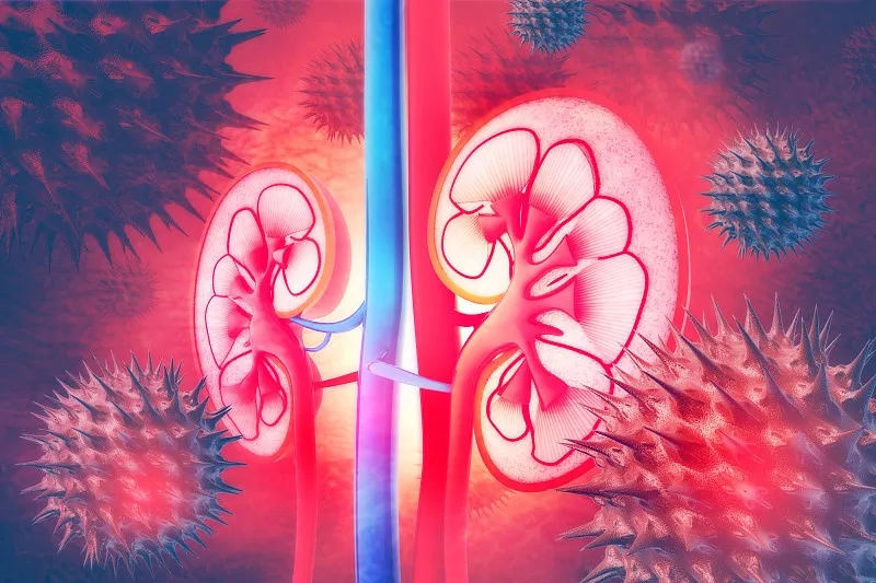 常見問(wèn)題解答:IgA腎病的進(jìn)展 常見問(wèn)題解答:IgA腎病的進(jìn)展