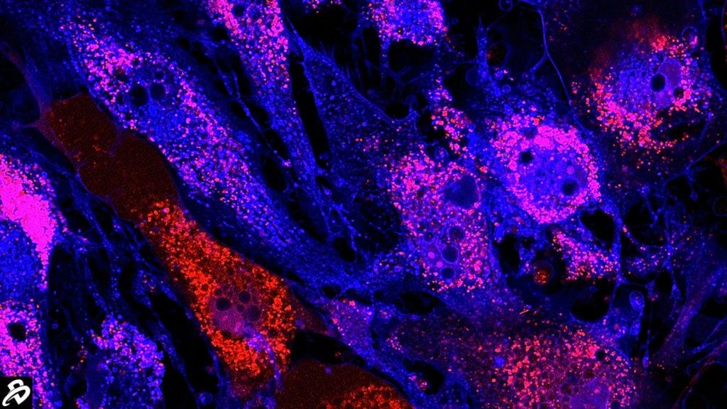 干細胞治療：未來醫學的新星，2030年獲批數量或將突破25款