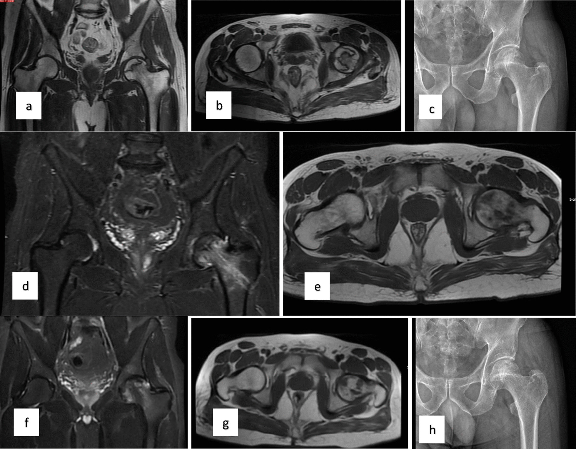 對患者的術前、3個月、6個月、1年和2年隨訪進行評估（圖1）。