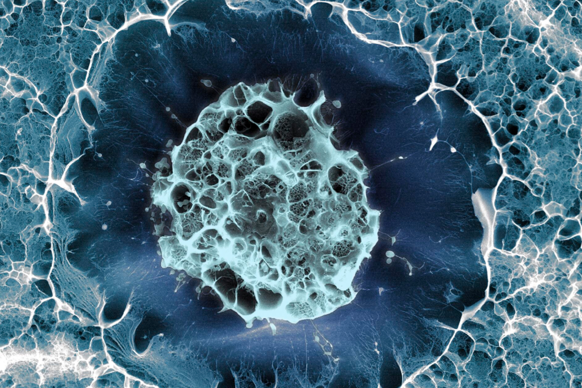 基于人類干細(xì)胞的帕金森病療法被證明是安全的