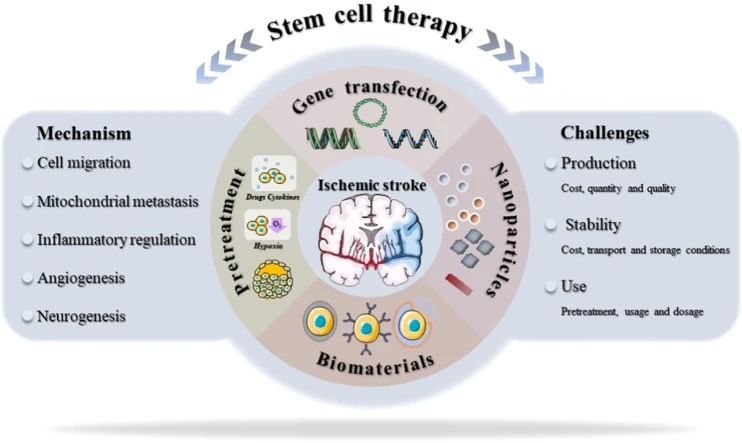 干細(xì)胞治療中風(fēng)新進(jìn)展：一項(xiàng)206人的隨機(jī)臨床試驗(yàn)結(jié)果揭曉啦！