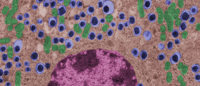 利用間充質(zhì)干細(xì)胞治療1型糖尿病的潛力如何？
