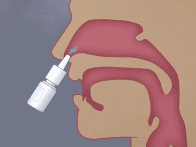 日本居家干細胞噴鼻能治療腦梗死：是科學突破還是商業噱頭？