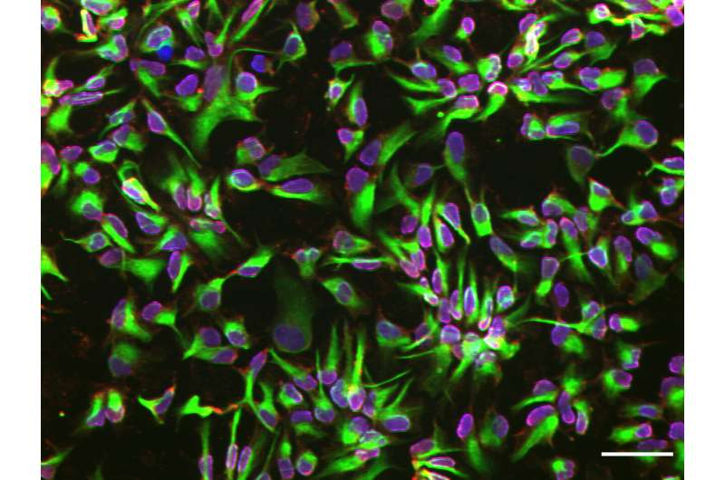 神經(jīng)干細(xì)胞 神經(jīng)干細(xì)胞