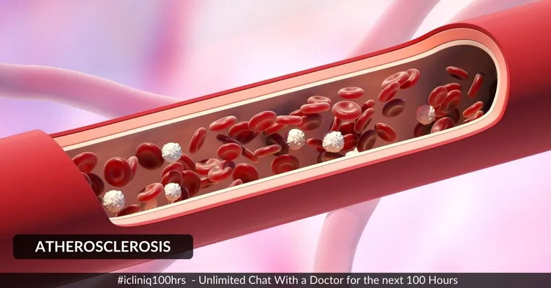 動脈粥樣硬化的體征和癥狀是什么？治療方案有哪些？