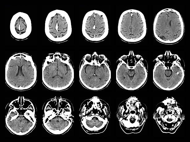 老年神經系統會出現哪些問題？