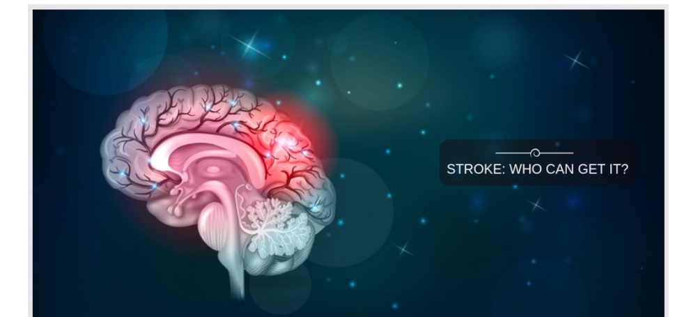 中風的癥狀和體征是什么-哪些人容易患中風？