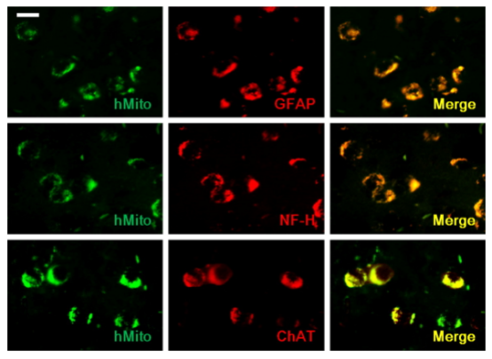 干細胞移植到小鼠腦組織后分化成神經元和星細胞