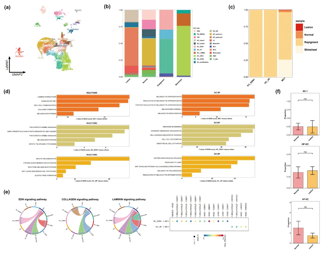 2024年干細(xì)胞治療白癜風(fēng)臨床案例