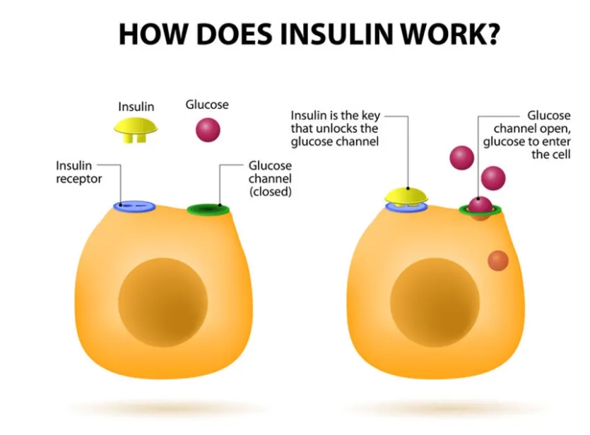 1型糖尿病的胰島素治療方案:類型與注射技巧 1型糖尿病的胰島素治療方案:類型與注射技巧