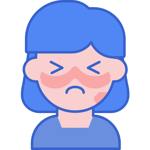 系統性紅斑狼瘡