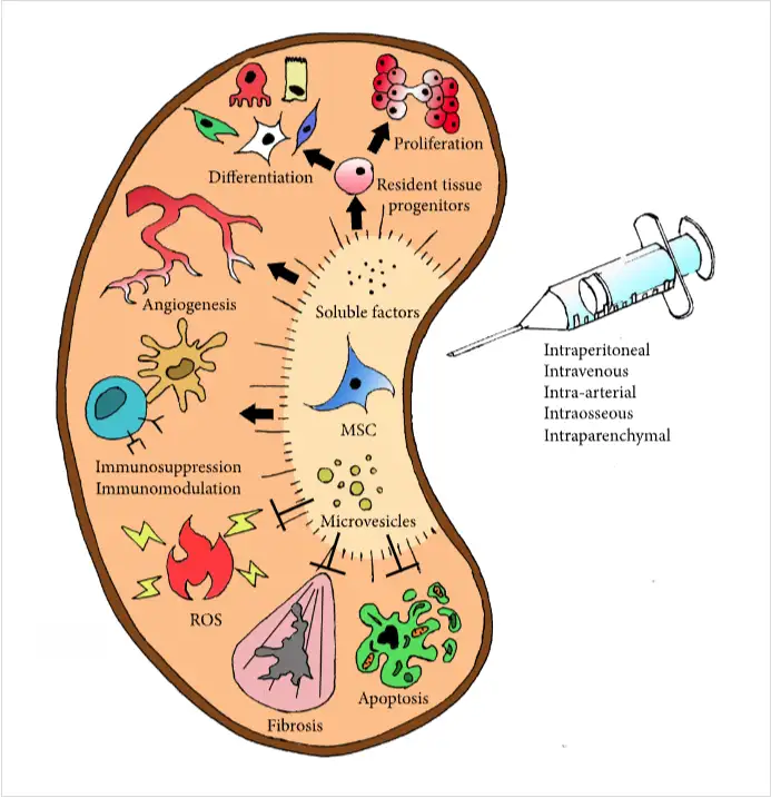 干細(xì)胞如何治療腎臟疾病？