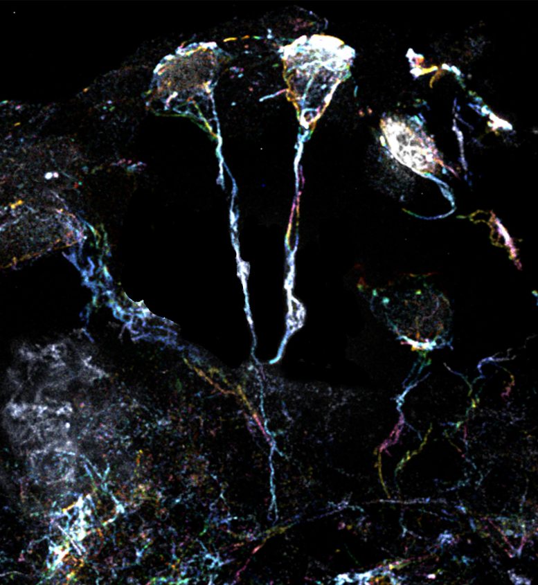 果蠅大腦中處于休眠狀態的神經干細胞具有富含肌動蛋白絲的突起