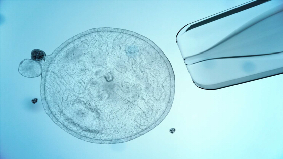 干細胞治療漸凍癥的作用機制