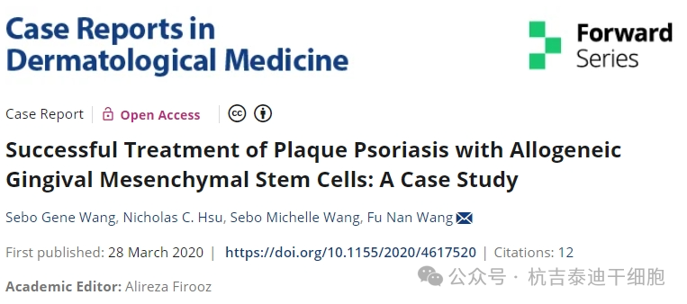 同種異體牙齦間充質干細胞成功治療斑塊性銀屑病:案例研究 同種異體牙齦間充質干細胞成功治療斑塊性銀屑病:案例研究