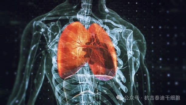 干細胞療法與呼吸系統 干細胞療法與呼吸系統