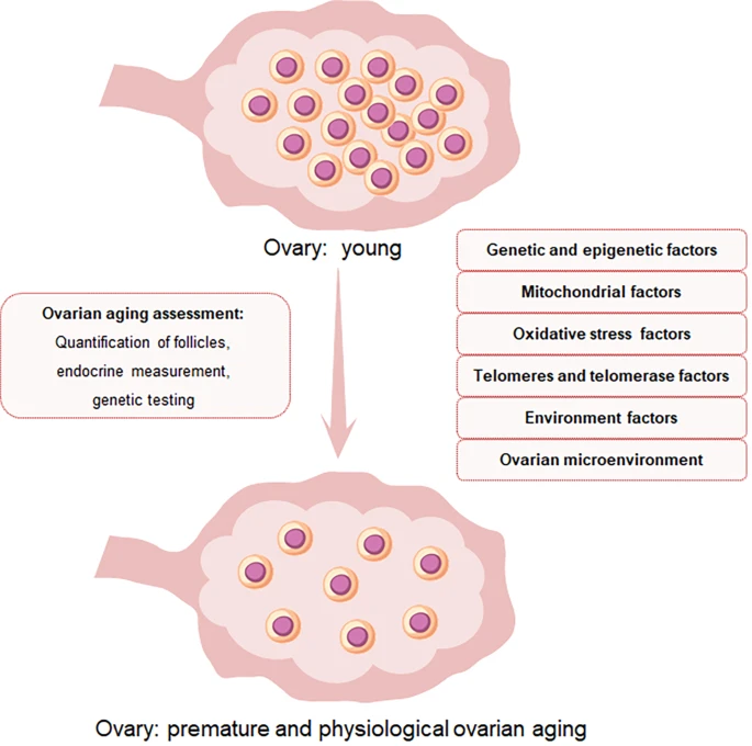 圖1：卵巢中卵泡數(shù)量和卵母細胞質(zhì)量與POI的關(guān)系示意圖