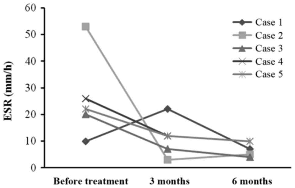 每位患者治療前后的 ESR。3 位患者的 ESR 明顯下降。ESR，紅細胞沉降率。