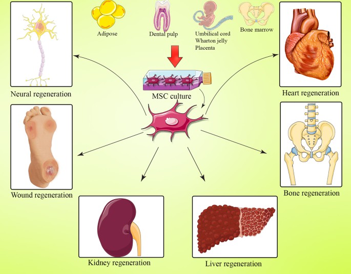 間充質(zhì)干細胞(MSC) 是一種多能細胞，可分化為基質(zhì)譜系細胞。間充質(zhì)干細胞(MSC) 是骨髓 (BM-MSC)、脂肪組織、肝臟、羊水、胚胎胎盤、臍帶血和其他組織中的一組非造血細胞。骨髓間充質(zhì)干細胞能夠抑制與GVHD病理生理學(xué)有關(guān)的大多數(shù)免疫細胞的激活和功能。