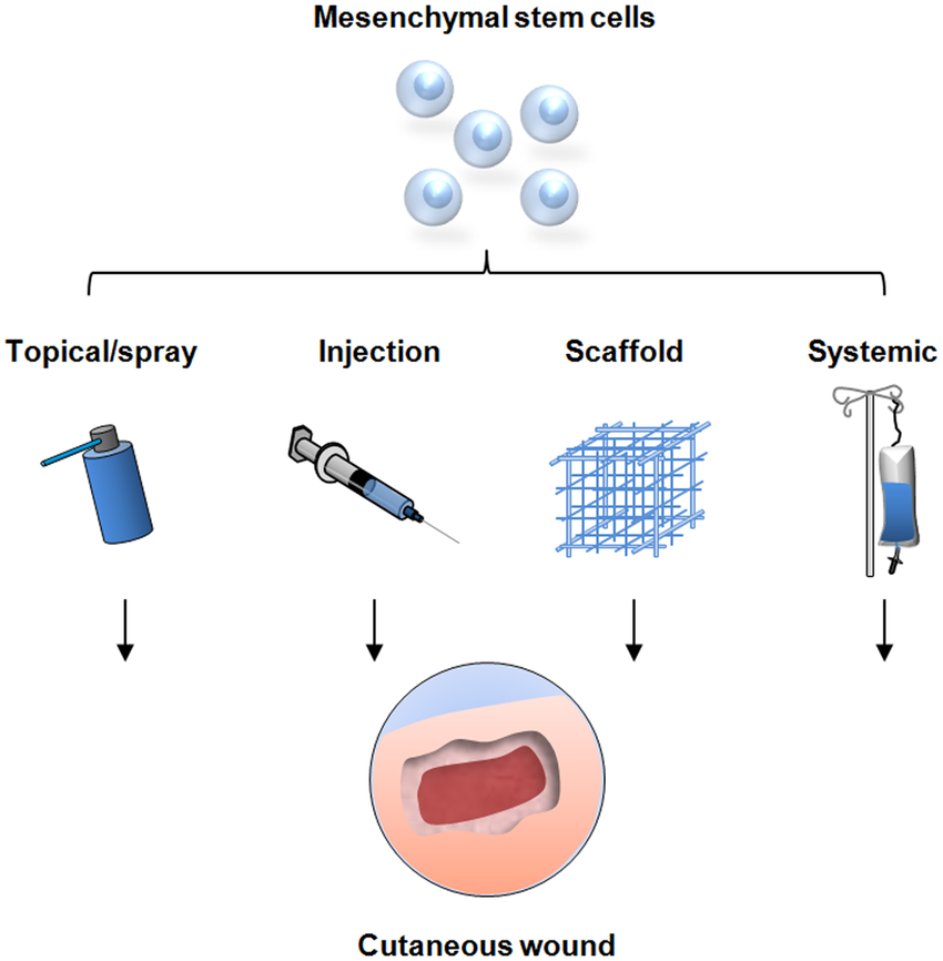 間充質干細胞的治療方式有哪些—從傳統細胞移植到現代生物技術的應用