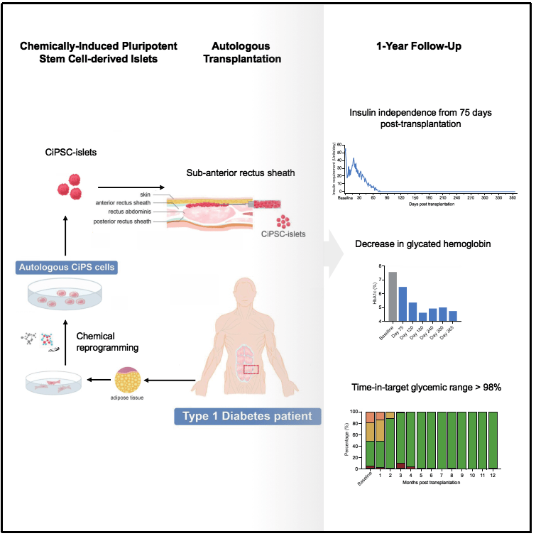 圖1：基于CiPS細胞治療1型糖尿病的臨床研究的示意圖和治療效果