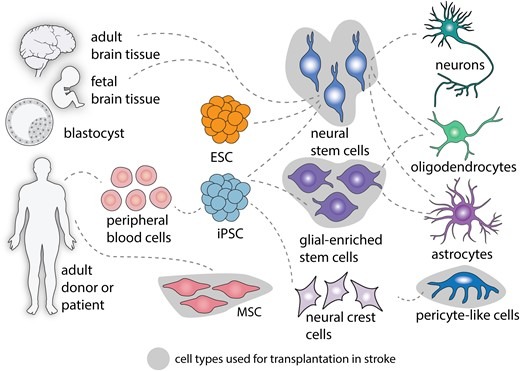 圖2：中風后細胞治療的細胞類型。