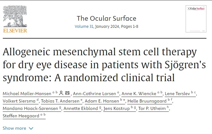 同種異體間充質干細胞治療干燥綜合征患者干眼癥：一項隨機臨床試驗
