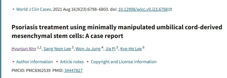 使用微操作臍帶來源的間充質干細胞治療銀屑?。翰±龍蟾? class=