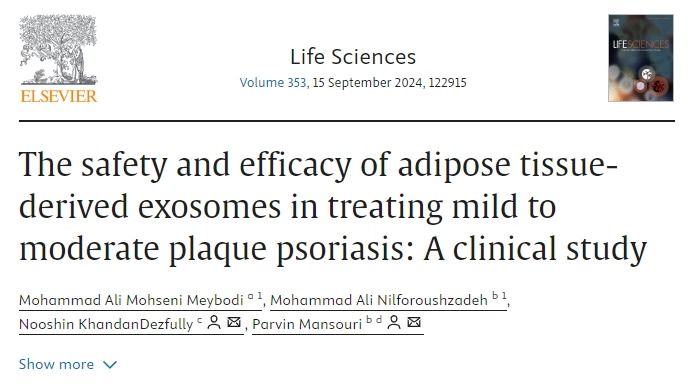 脂肪組織衍生外泌體治療輕中度斑塊狀銀屑病的安全性和有效性：一項臨床研究