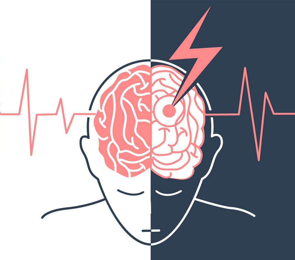 宣武醫院發布：間充質干細胞治療中風，可以改善患者神經功能障礙