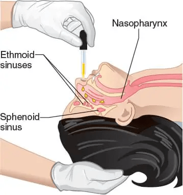 干細胞輸送方法有13種，其中干細胞移植的過程都是什么樣的？