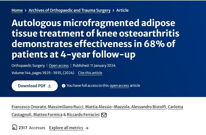 自體微碎片脂肪組織治療膝關節骨關節炎在4年隨訪中顯示對68%的患者有效