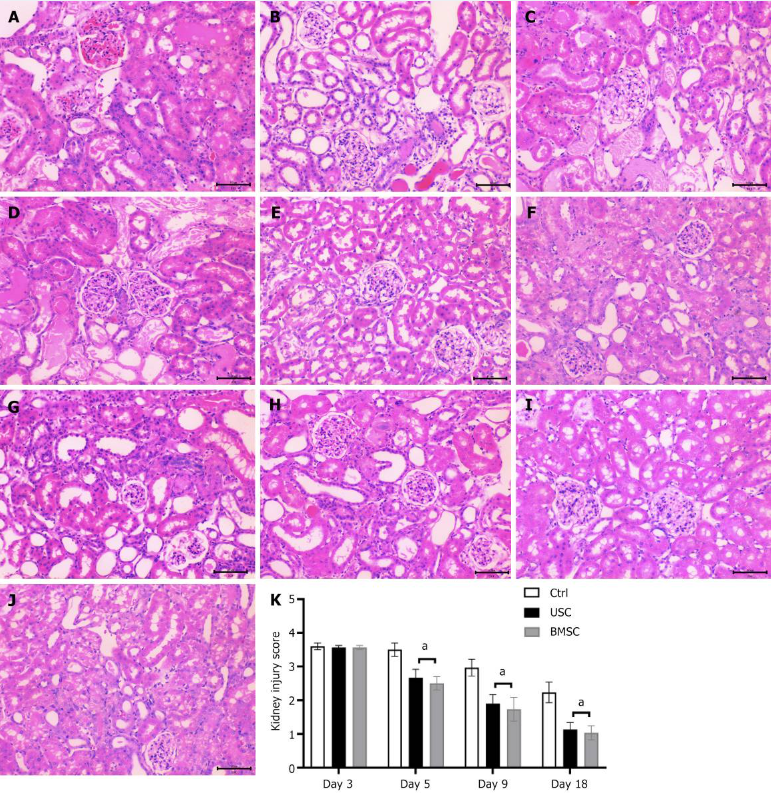 圖4：通過蘇木精和伊紅染色（200 ×）對尿液來源的干細(xì)胞治療、骨髓間充質(zhì)干細(xì)胞治療和對照未治療小鼠的急性腎損傷進(jìn)行組織學(xué)檢查。