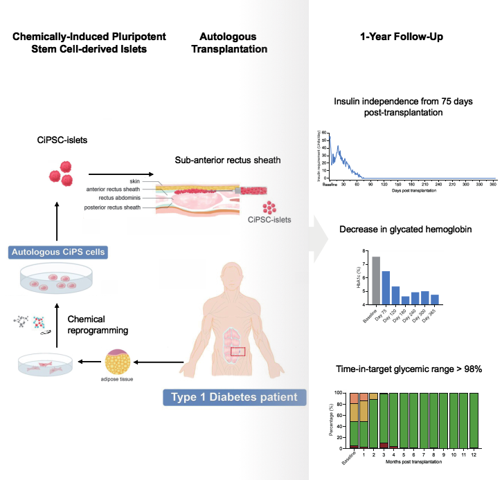 圖2：SLE患者接受CAR-T細胞治療的程序和結果。