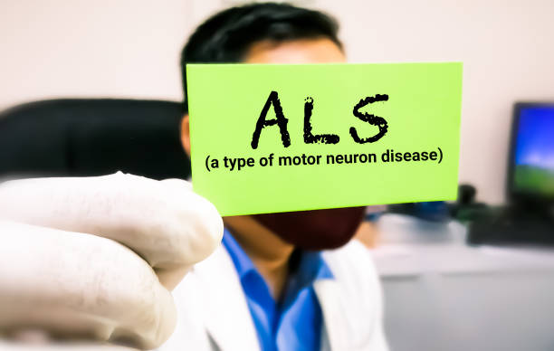 干細胞療法治療漸凍癥：間充質干細胞、神經干細胞和誘導性多能干細胞的療效比較